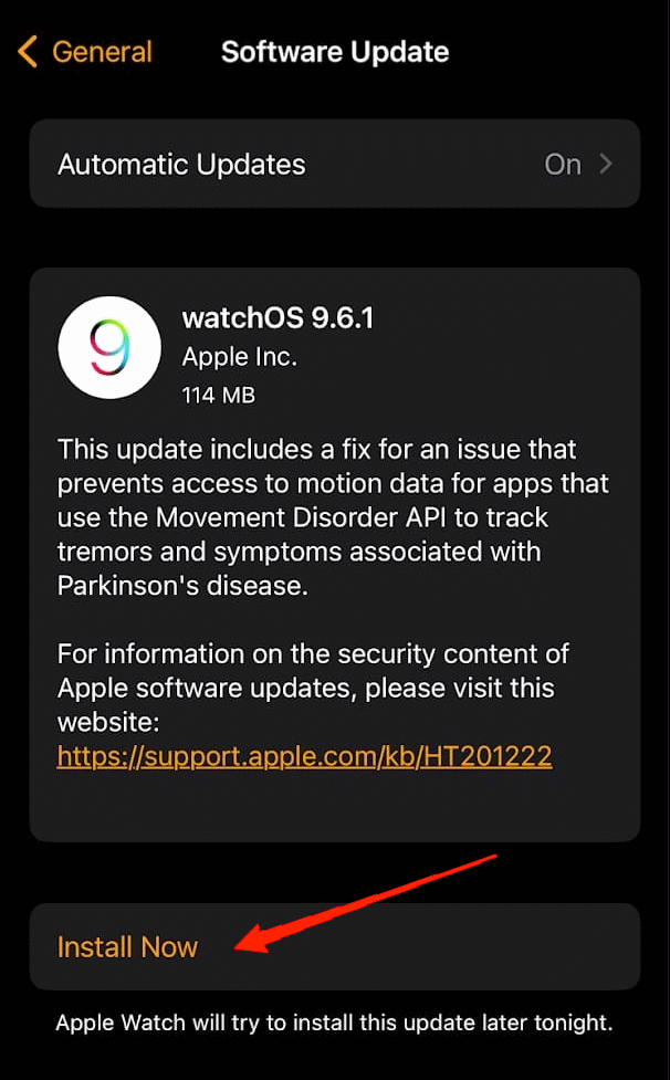 10 Ways to Fix Apple Watch Not Vibrating 16 10 Ways to Fix Apple Watch Not Vibrating 2